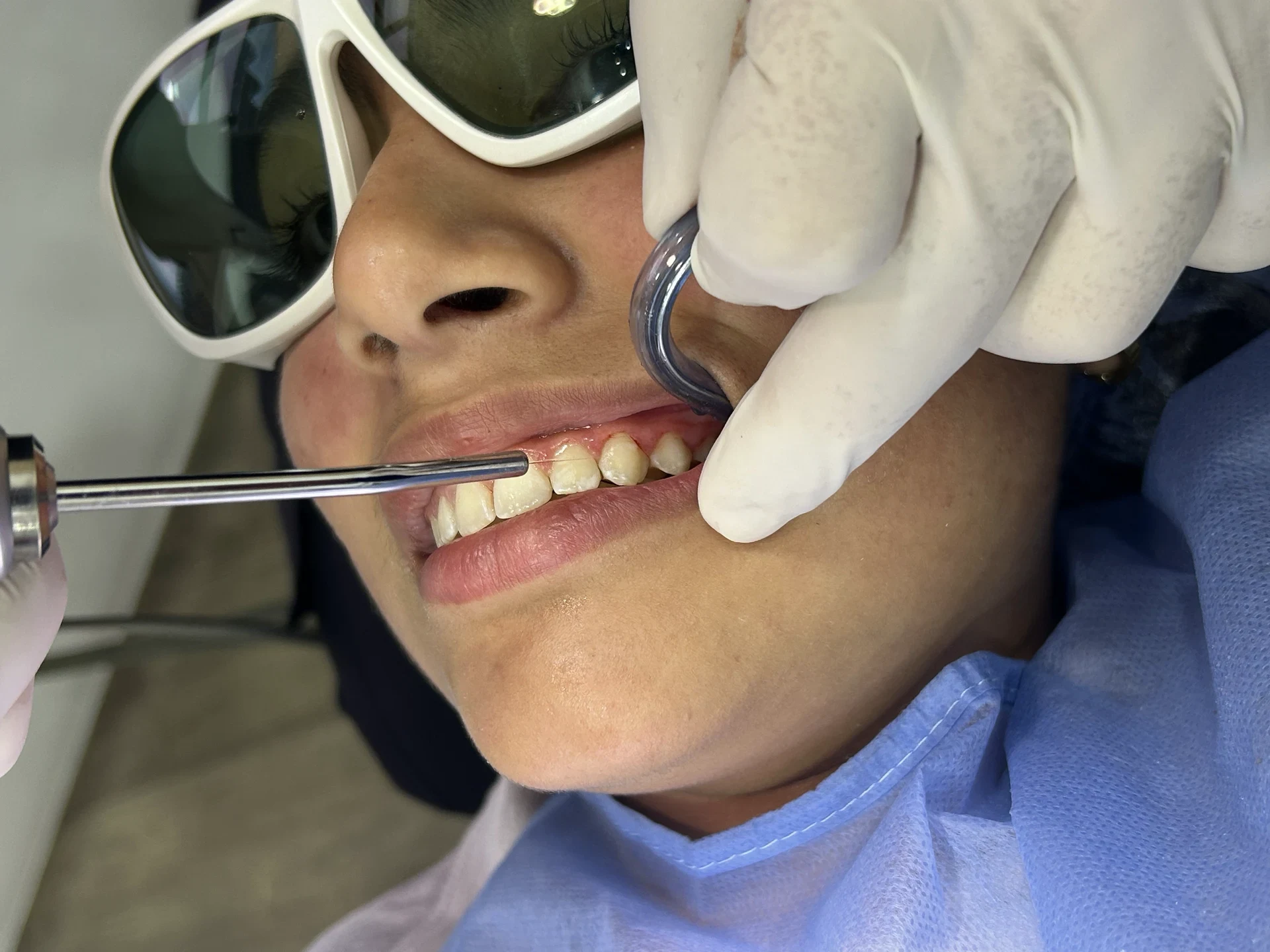 Odontología General y Preventiva en MDental Láser, El Poblado, Medellín