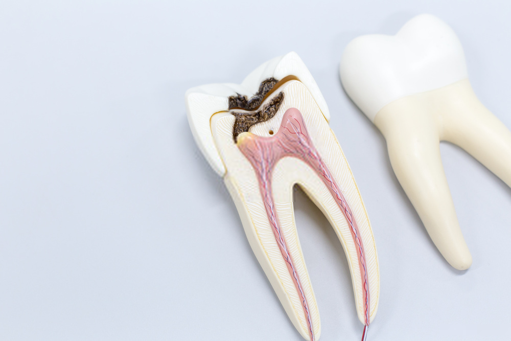 Elimina el mal aliento para siempre - Axioma Estudi Dental